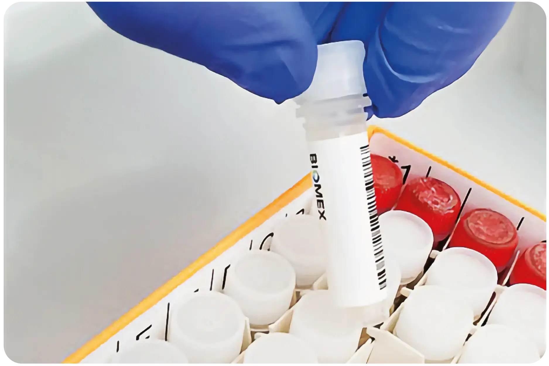 Pbmc Socket Human PBMCs for research | Disease-State PBMCs | BIOMEX